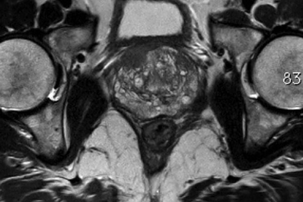 thumb-diagnosis1
