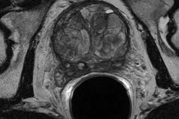 thumb-diagnosis3