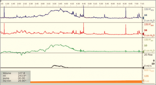 29xgrypagx8gw4s888